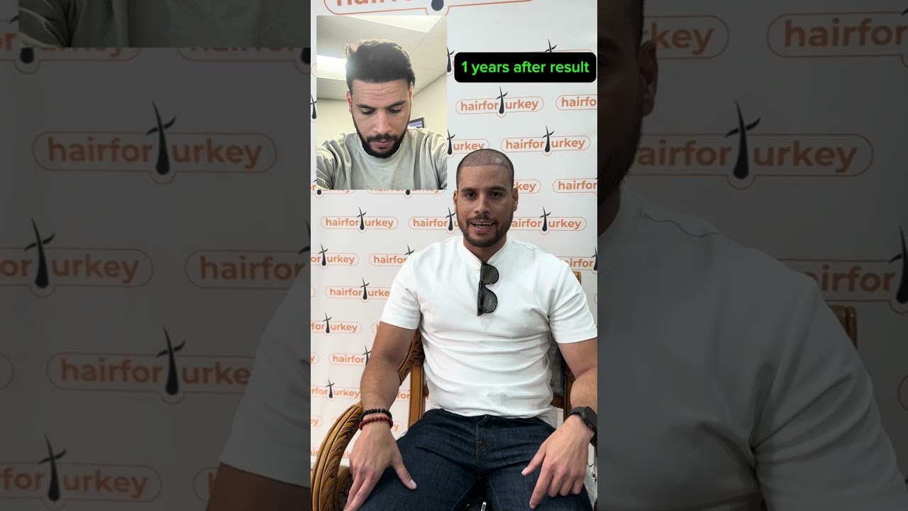 Greffe de Cheveux à Casablanca : Résultats, Processus & Avis & Avant / Apres ( 2026 ) HAİRFORTURKEY 