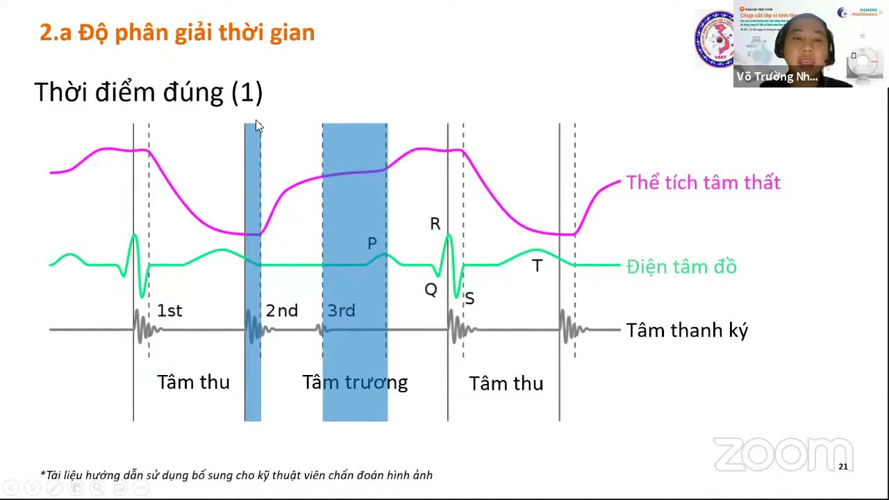 Khóa học CHỤP CẮT LỚP VI TÍNH TIM MẠCH Buổi 2