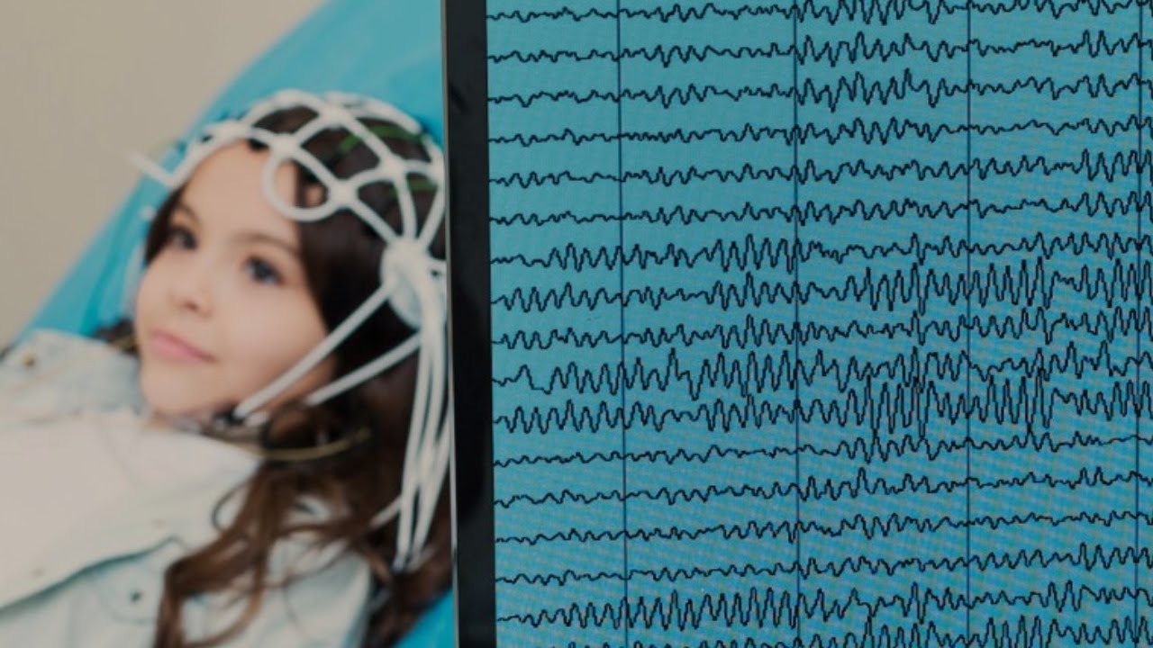 Wprowadzenie do EEG BFB cz.3