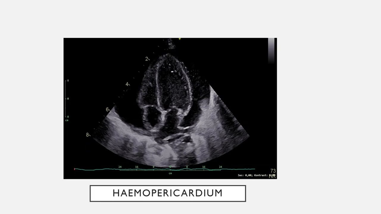 POCUS, MRCEM INTERMEDIATE SBA