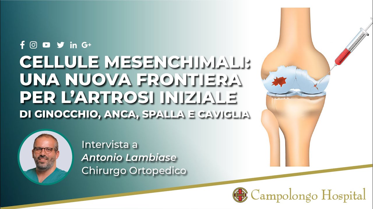 Cellule staminali, o mesenchimali: nuova frontiera per l’artrosi non severa