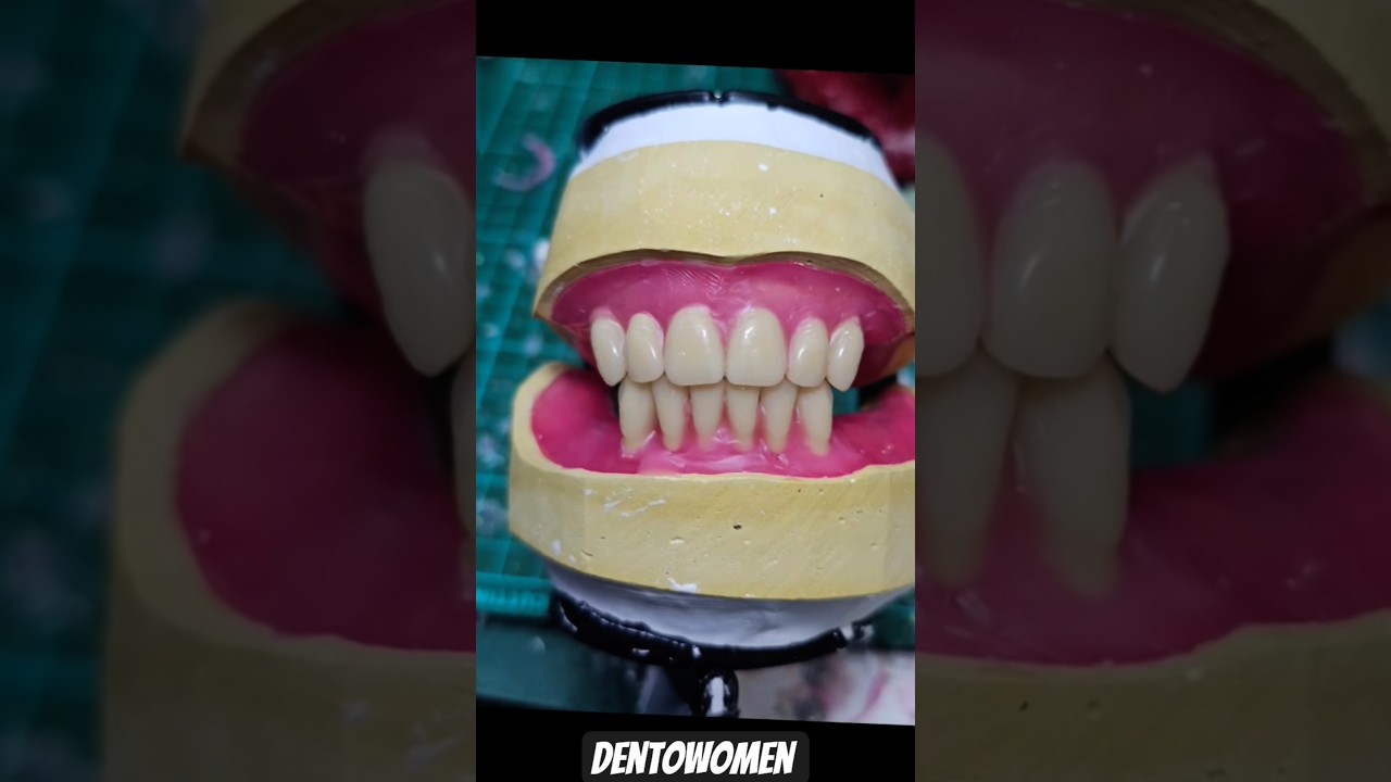 anterior teeth arrangement | Dentowomen 