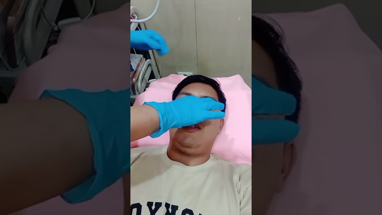 Alartox, After Hiko Nose Lift