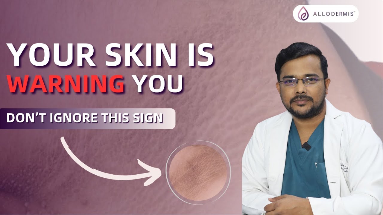 Dark Neck or Underarms? This Could Be Your Body’s Early Warning | Dermatologist Explains