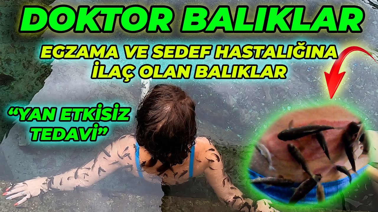 DERİ HASTALIKLARINA İYİ GELEN ŞİFACI BALIKLAR - Kangal Balıklı Kaplıcası / Sivas - Kangal
