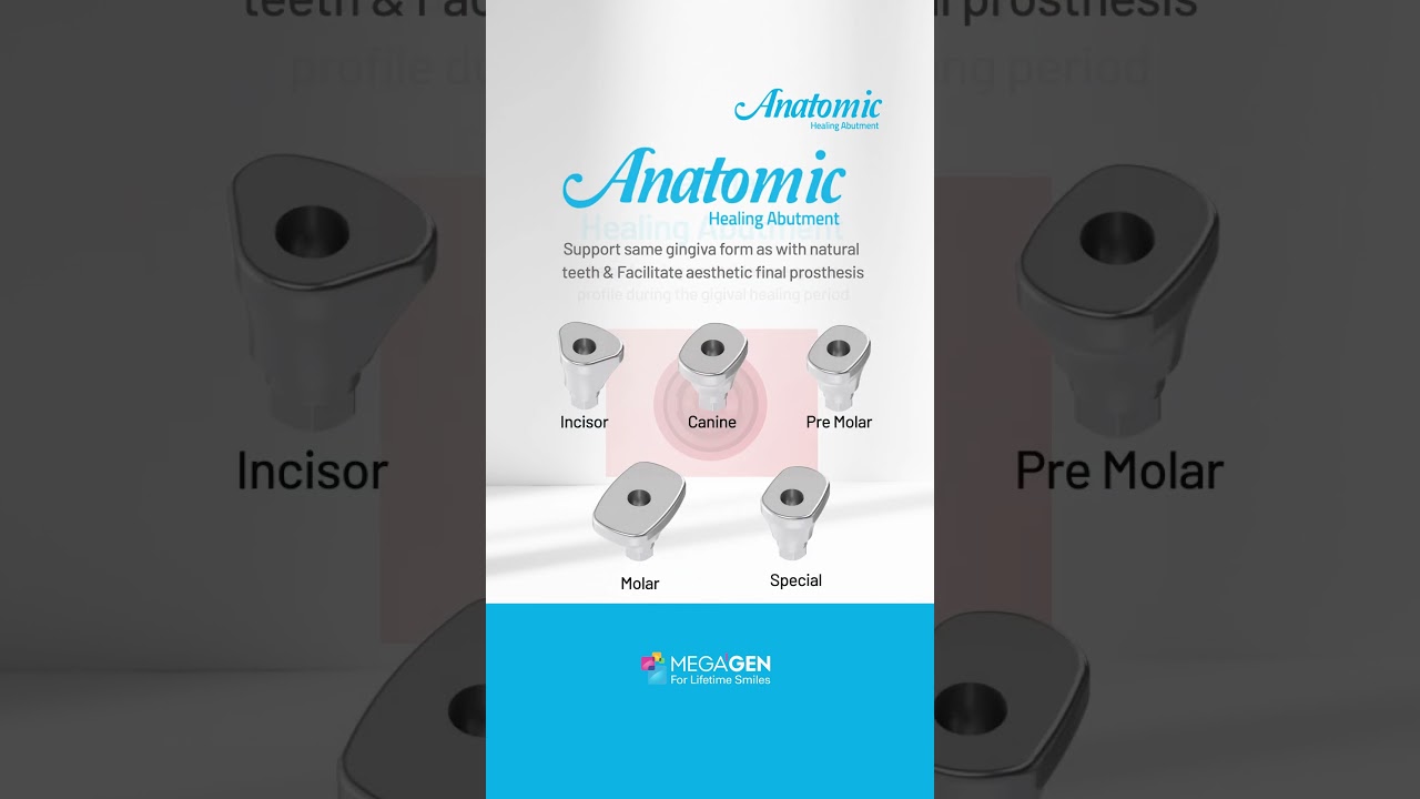 𝐀𝐧𝐚𝐭𝐨𝐦𝐢𝐜 𝐇𝐞𝐚𝐥𝐢𝐧𝐠 𝐀𝐛𝐮𝐭𝐦𝐞𝐧𝐭 - Aesthetic final prosthesis, like natural teeth