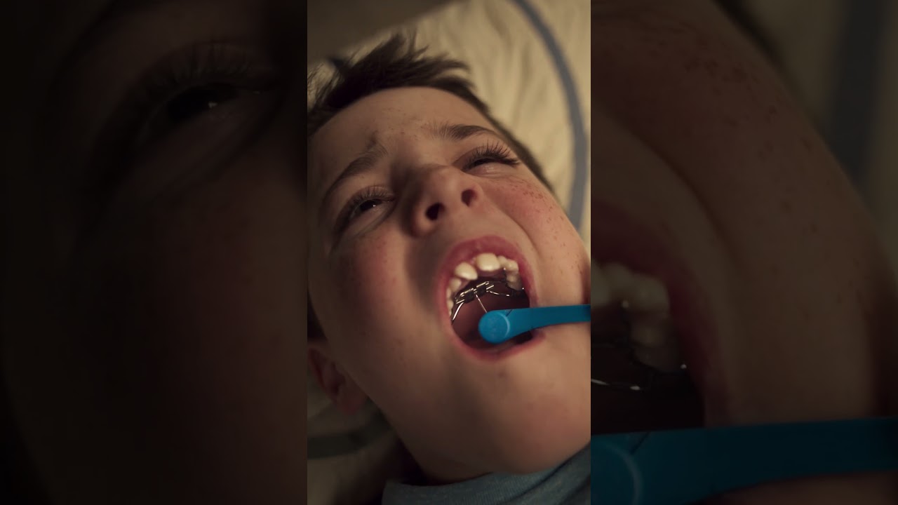 The better way to palatal expansion
