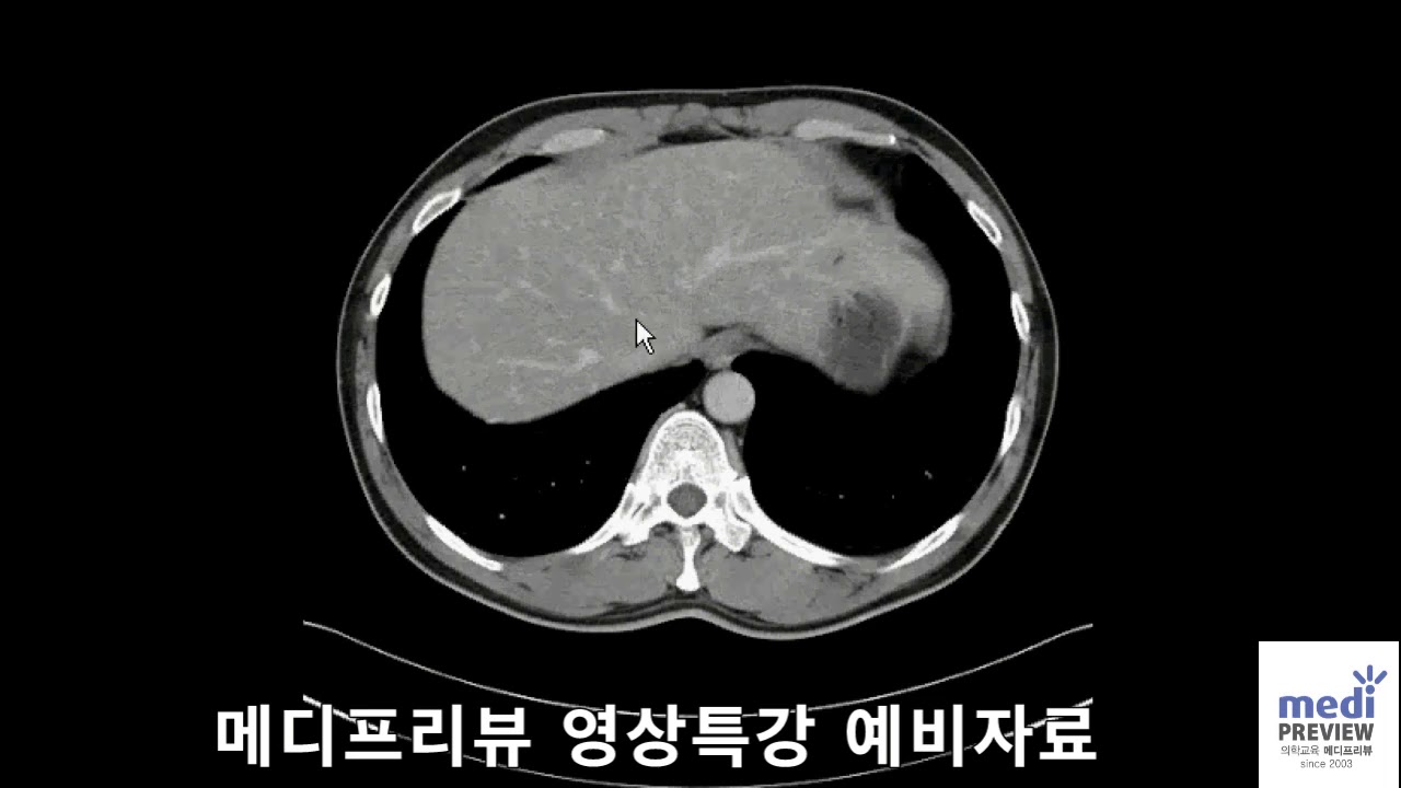 영상의학 특강 예비자료 1  - Abdomen CT anatomy  #영상의학 #의사국가고시 #의사국시 #메디프리뷰