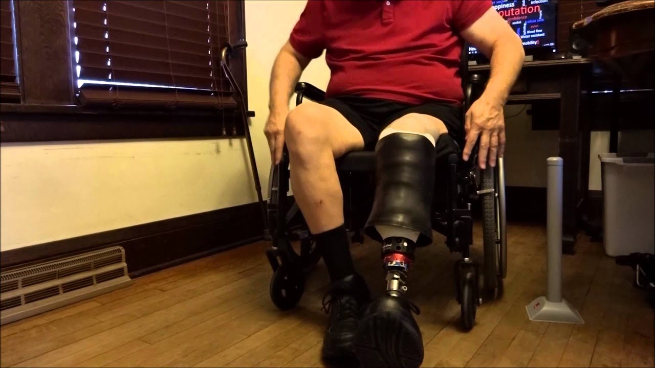 Elevated Vacuum Prosthesis