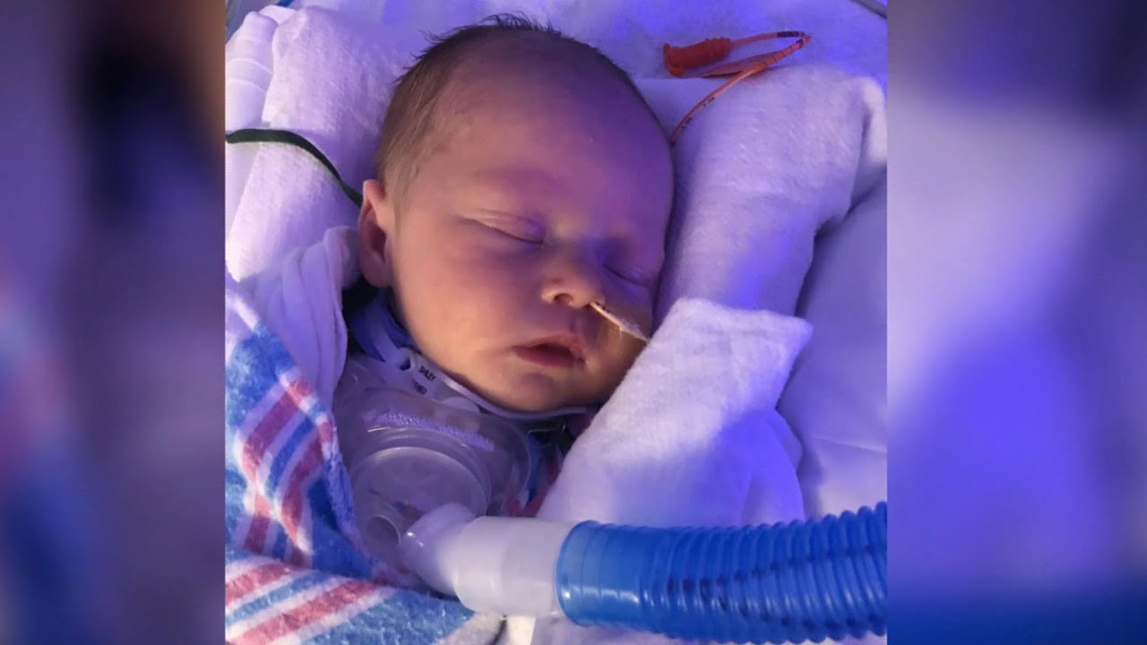 Vocal cord surgery gives toddler a voice