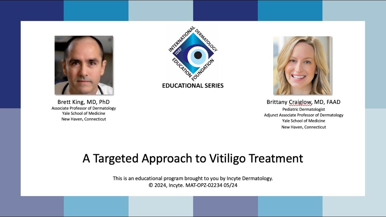 IDEF Educational Series  A Targeted Approach to Vitiligo Treatment