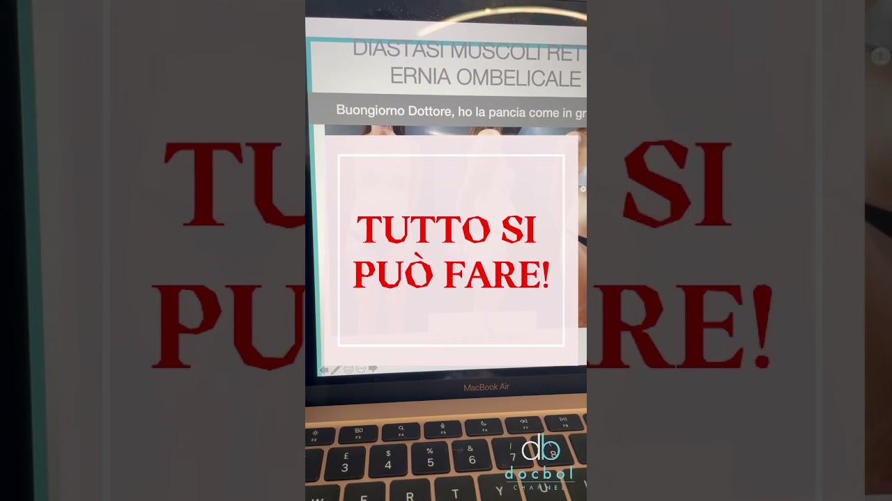 Via la diastasi muscoli retti