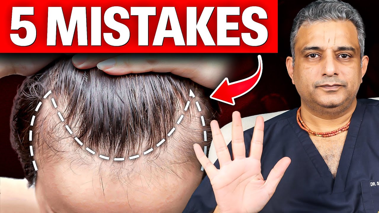 Reality of Hair Loss in Your 20s and 40s 😵 Receding Hairline, Male Pattern Baldness