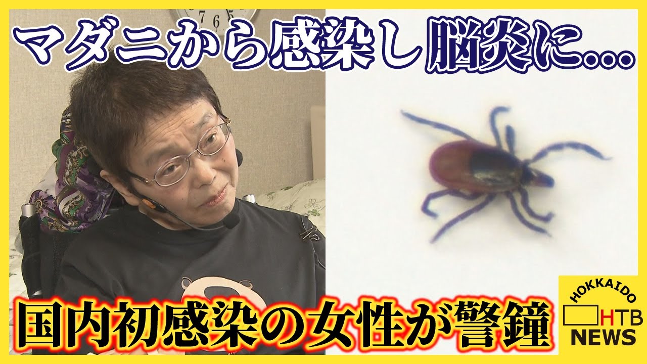 山に入る際に注意を マダニから感染するダニ媒介脳炎 国内初の感染者が恐ろしさを語る