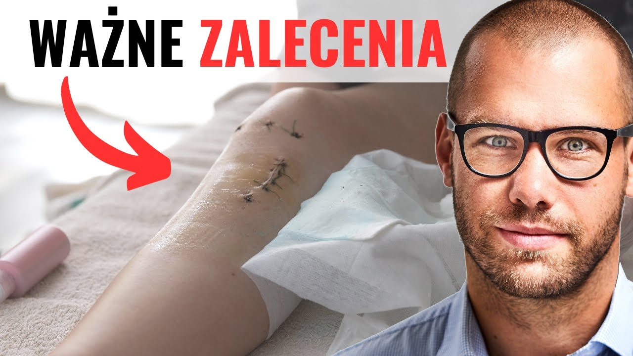REHABILITACJA ACL - po REKONSTRUKCJI - Wszystko co musisz wiedzieć!