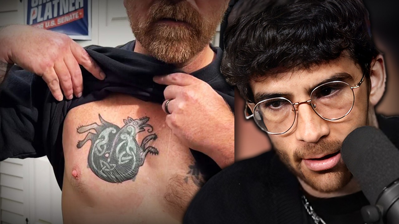 So He Covered The Tattoo...