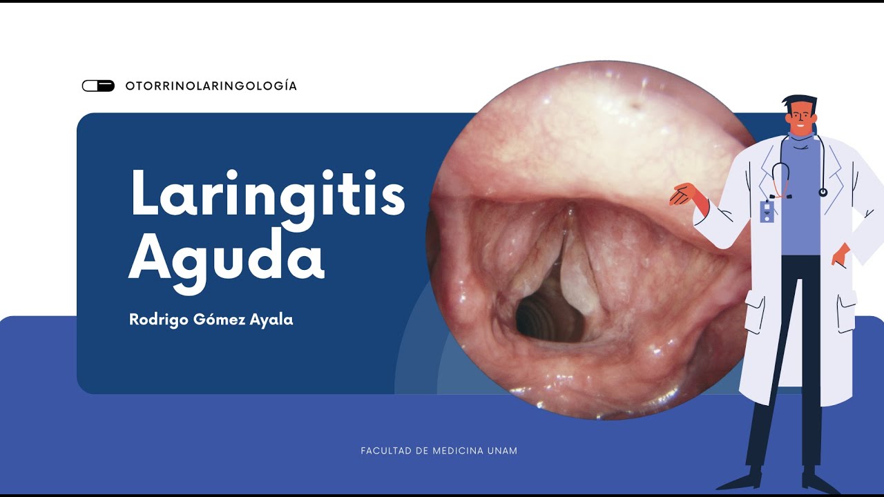 Laringitis aguda