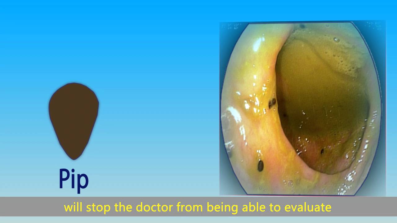 Preparation for colonoscopy