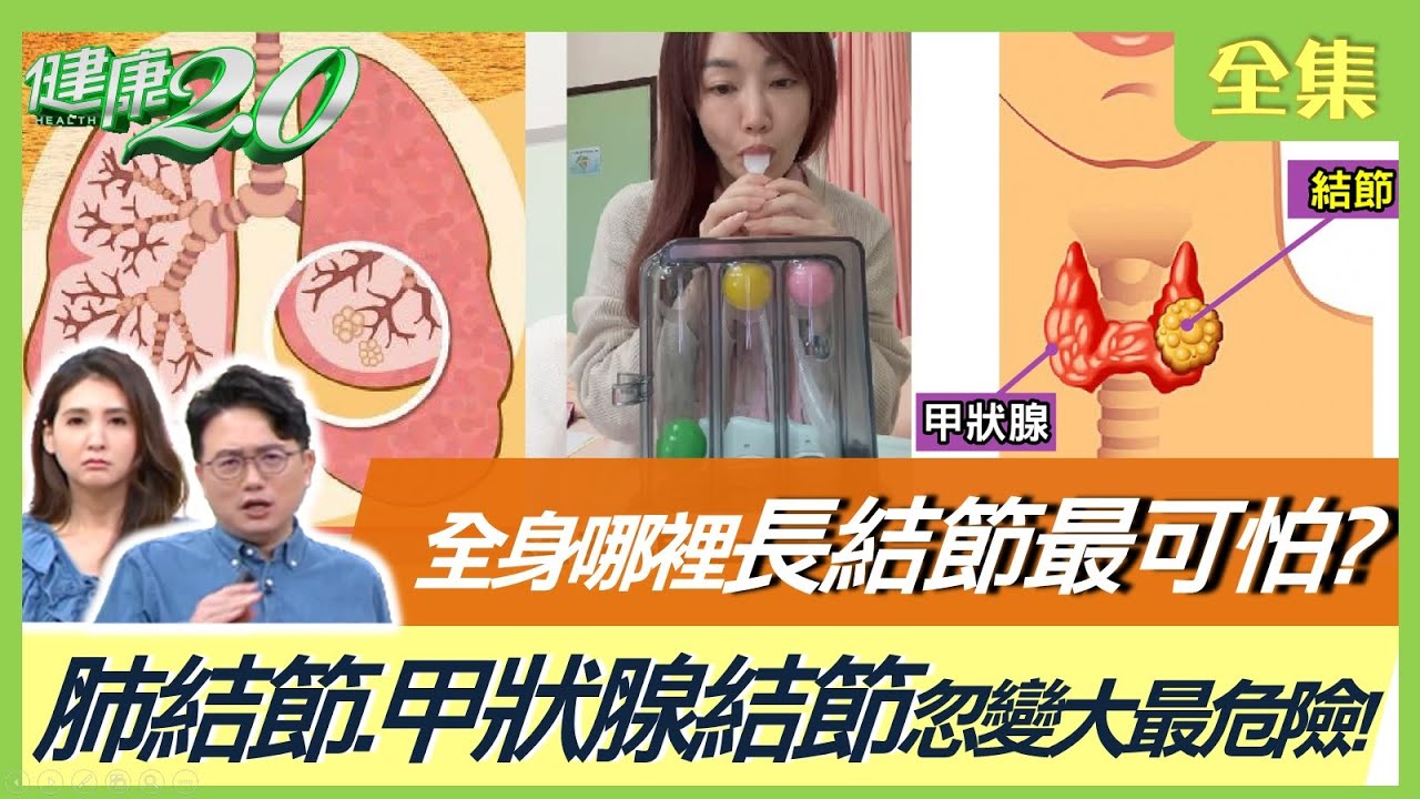 吳淡如驚曝20顆肺結節！肺結節.甲狀腺結節忽變大最危險！全身哪裡長結節最可怕？九轉乾坤功暢通氣血！中醫肺結節病徵怎麼緩解？ 健康2.0 20220424 (完整版)