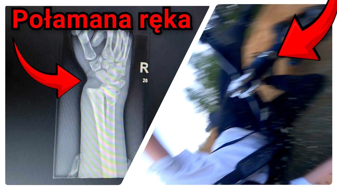 STRZELECKA ZNISZCZONA | POŁAMANA RĘKA NA ROADGPIE | PRZERWA OD JAZDY