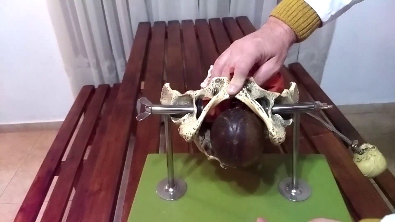 Mecanismo de Parto Podálico