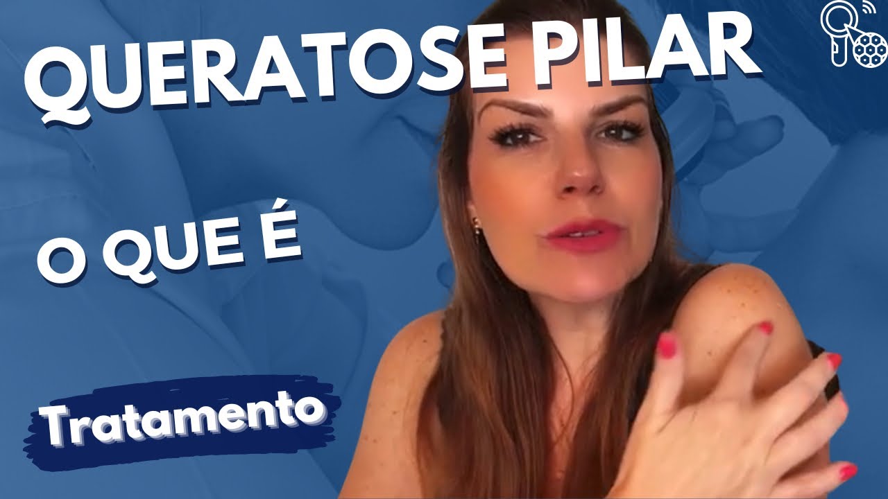 Queratose Pilar - as indesejadas bolinhas no braço - o que são e como tratar