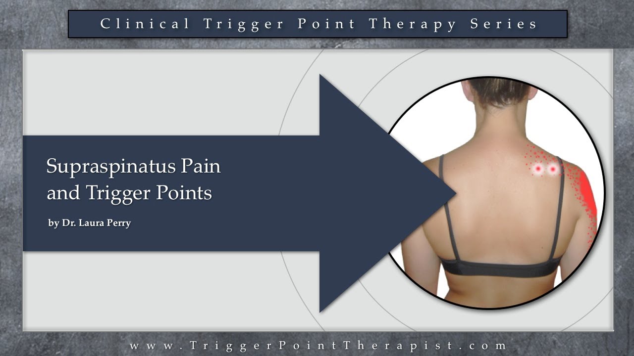 Supraspinatus Pain and Trigger Points