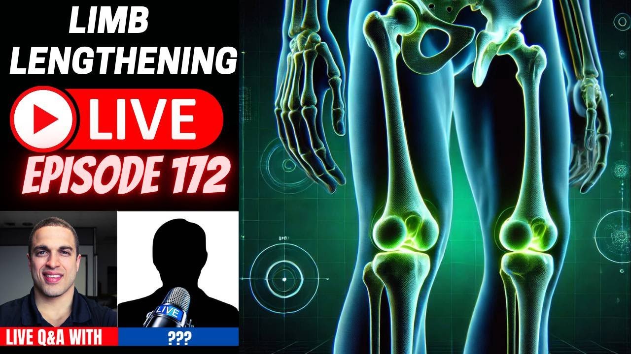 Limb Lengthening LIVE Ep. 172 – CodeManRed Before & After + Update on PRECICE Nail Pricing