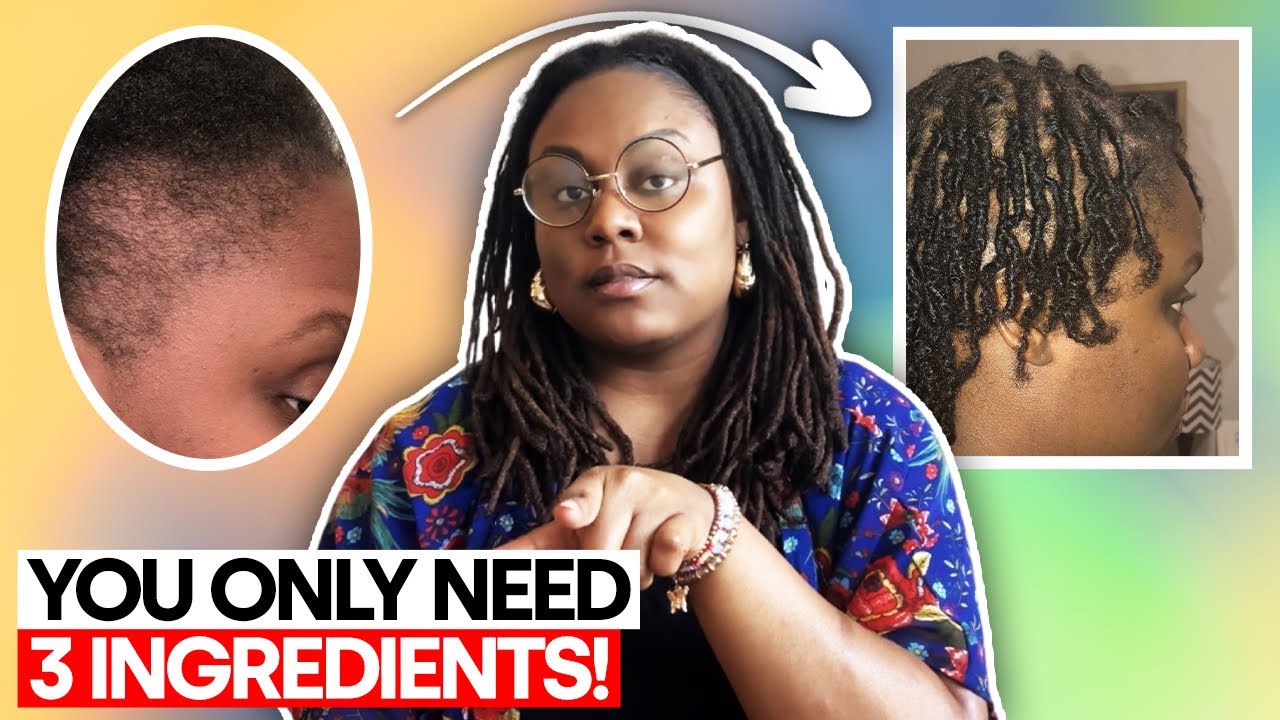How I Grew My Starter Locs & Edges Back FAST |  Use This Weekly For Rapid Hair Growth😮