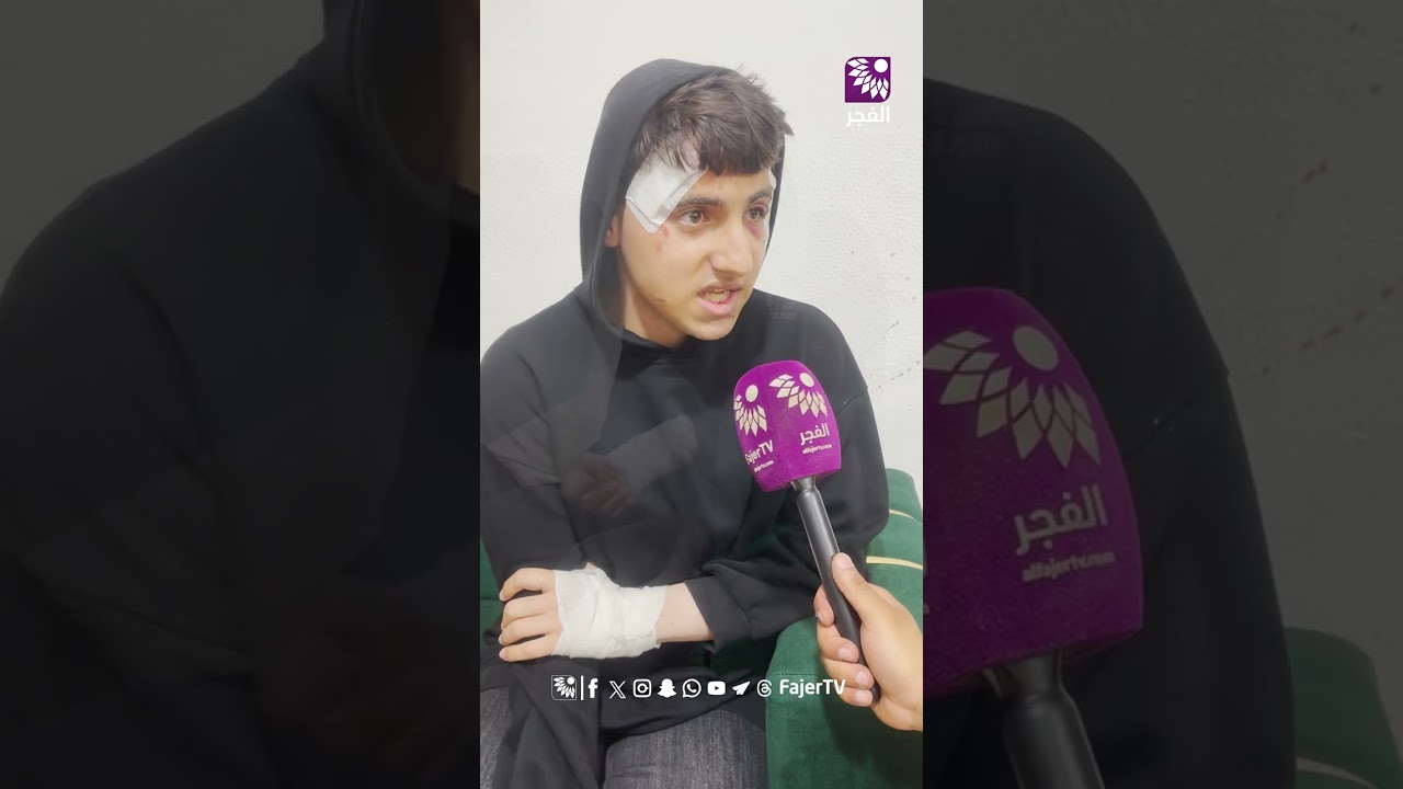 هذا ما فعله جنود الاحتلال بالطفل محمد سوقية من جنين !