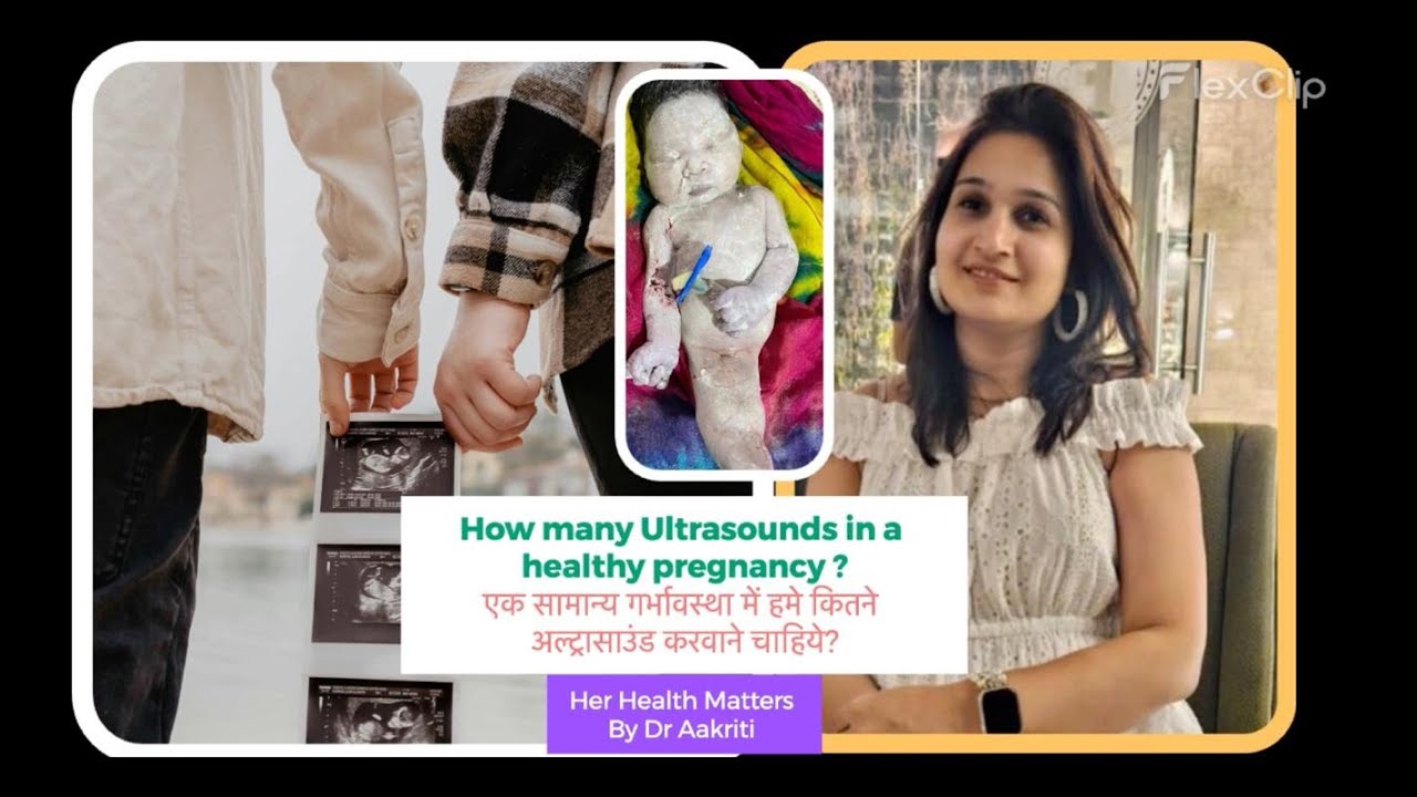 Normal Pregnancy में कितने सोनोग्राफी करवाने चाहिए? How many USGs in a Normal pregnancy?
