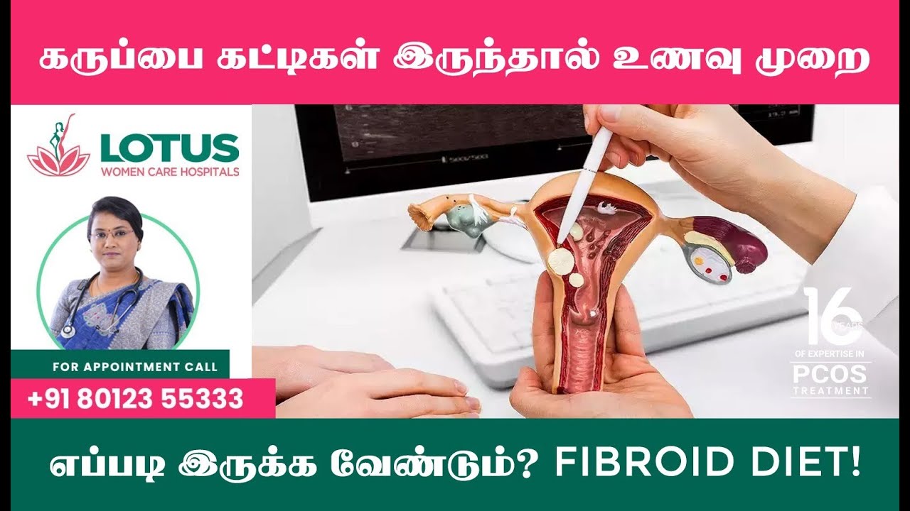 கருப்பை கட்டிகள் வளராமல் தடுக்க!(FIBROID DIET) │Natural Fertility Centre in Tamil Nadu