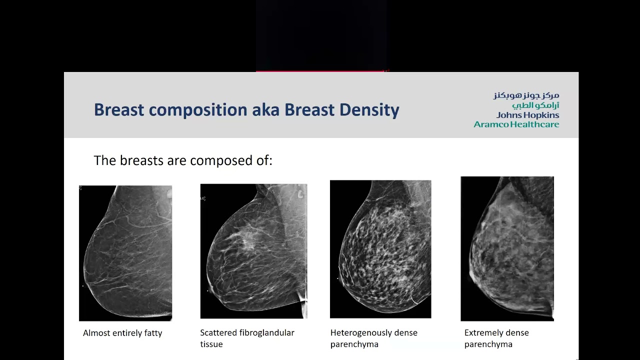 Screening Mammogram: Understanding your Mammogram Report