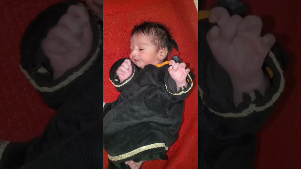 Newborn Baby’s First Cry After Birth 😢💖 | 4.1 KG Baby | Suction & Injury Care Process