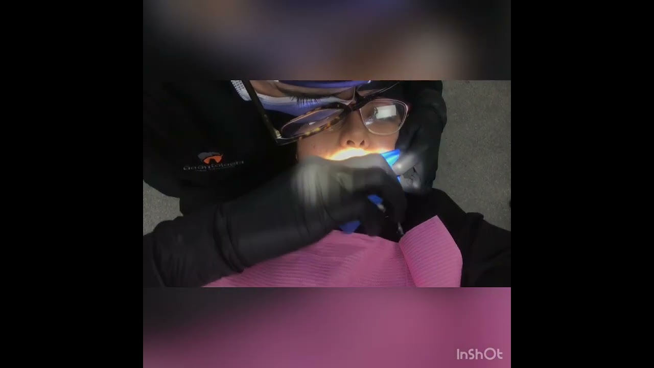 Video-Colocacion de dique de hule