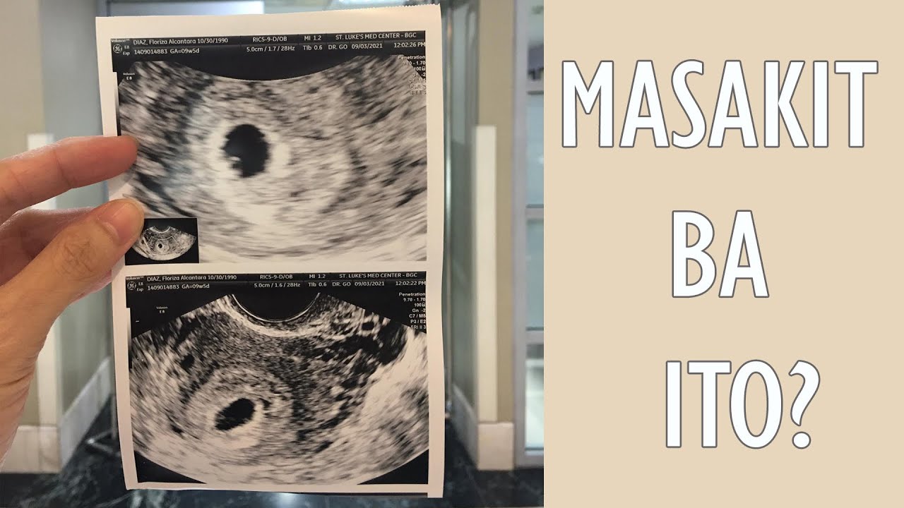 TRANSVAGINAL ULTRASOUND | Step by step process of TRANSVAGINAL ULTRASOUND in ST. LUKE’s BGC