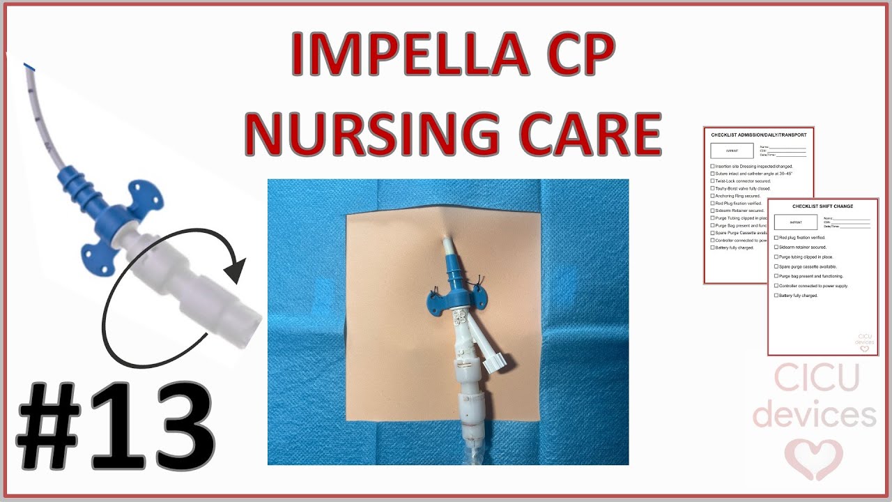 STEP-BY-STEP IMPELLA CP NURSING CARE. HOW TO MANAGE THE DEVICE (IMPELLA GUIDE 012)