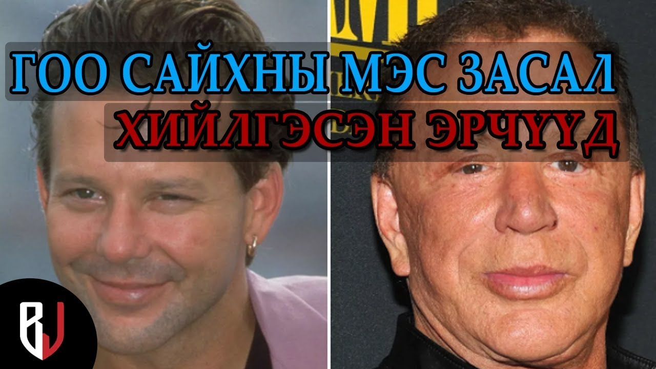 Гоо сайхны мэс засал хийлгэсэн алдартай эрчүүд
