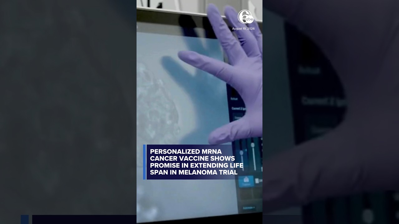 Personalized mRNA cancer vaccine shows promise in extending life span in melanoma trial