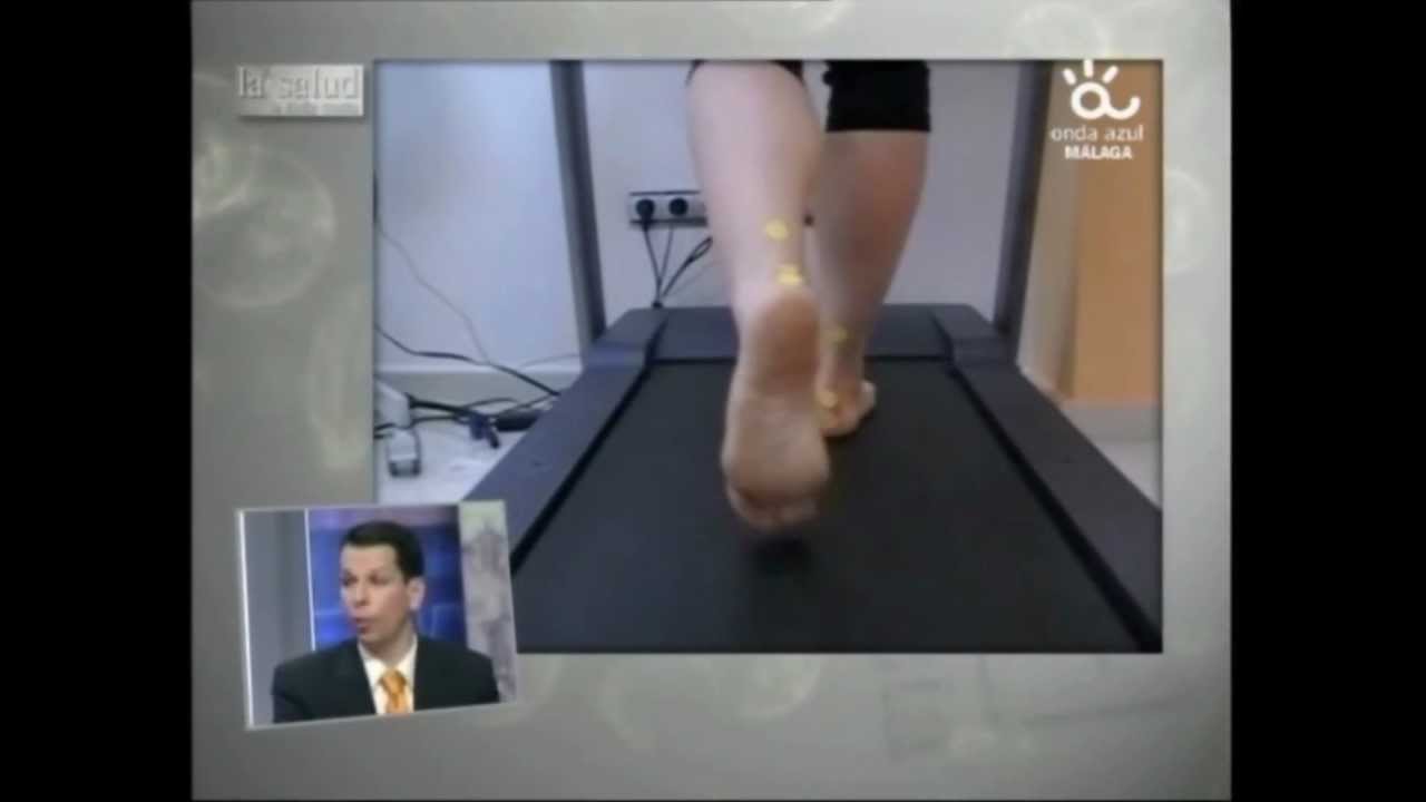 Periostitis Tibial. Biomecánica y tratamientos