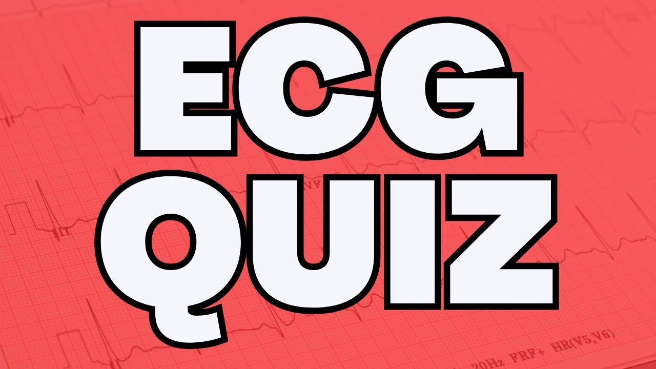 ECG Quiz Collection