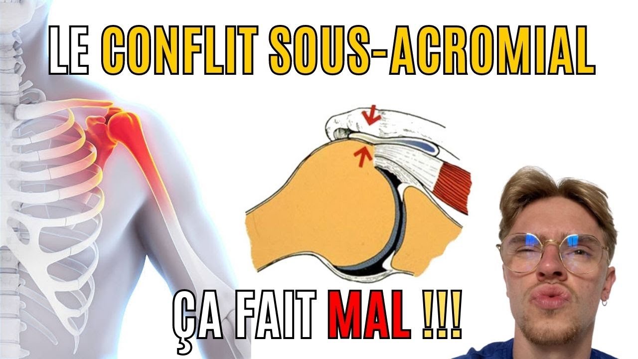 Douleur à l’épaule ? Le conflit sous-acromial