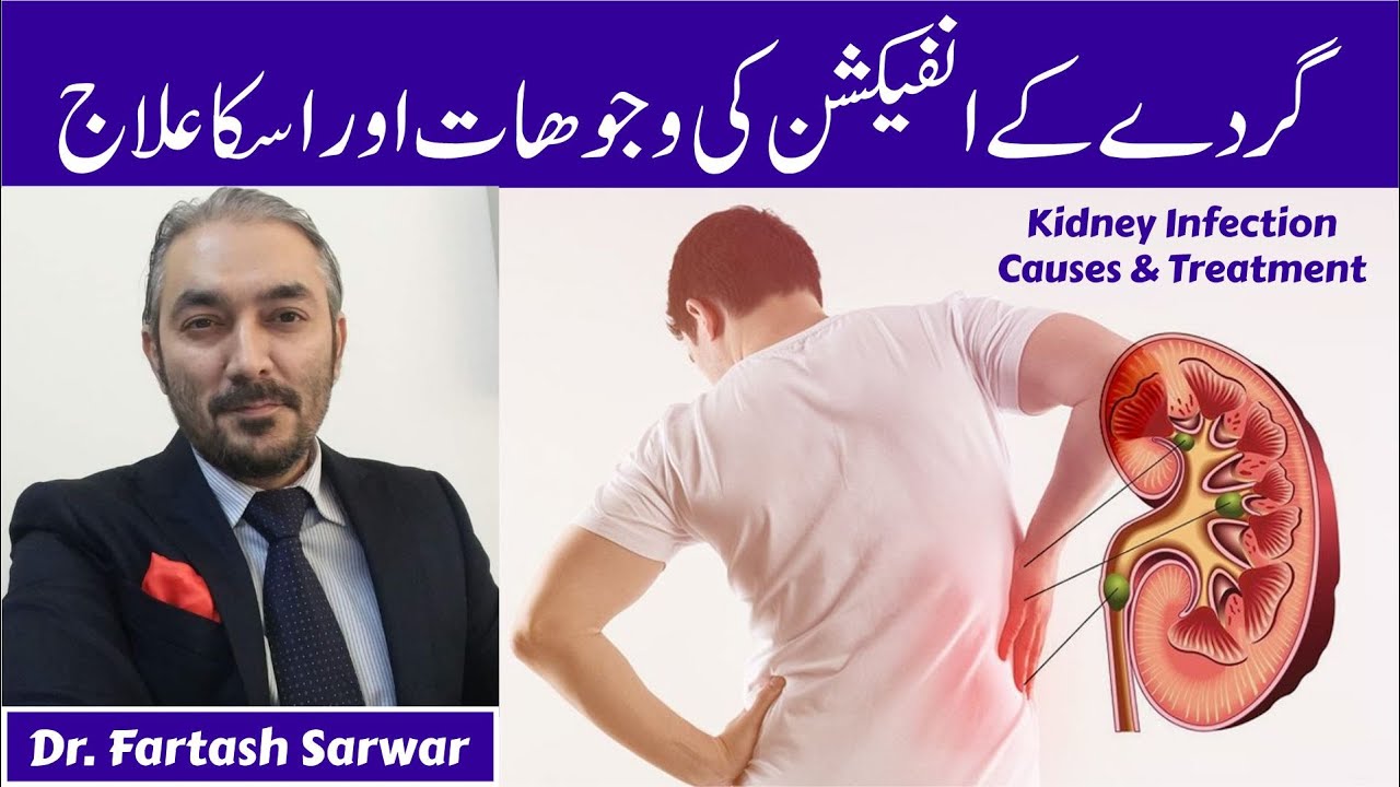 Major Causes & Treatment Of Kidney Infection | گردے کا انفیکشن | Dr. Fartash Sarwar | Urologist