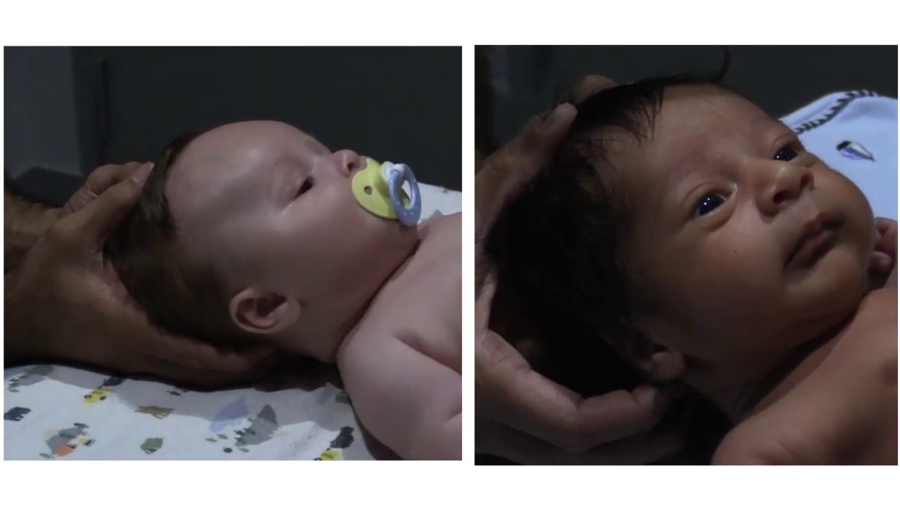 Pediatric Osteopathy