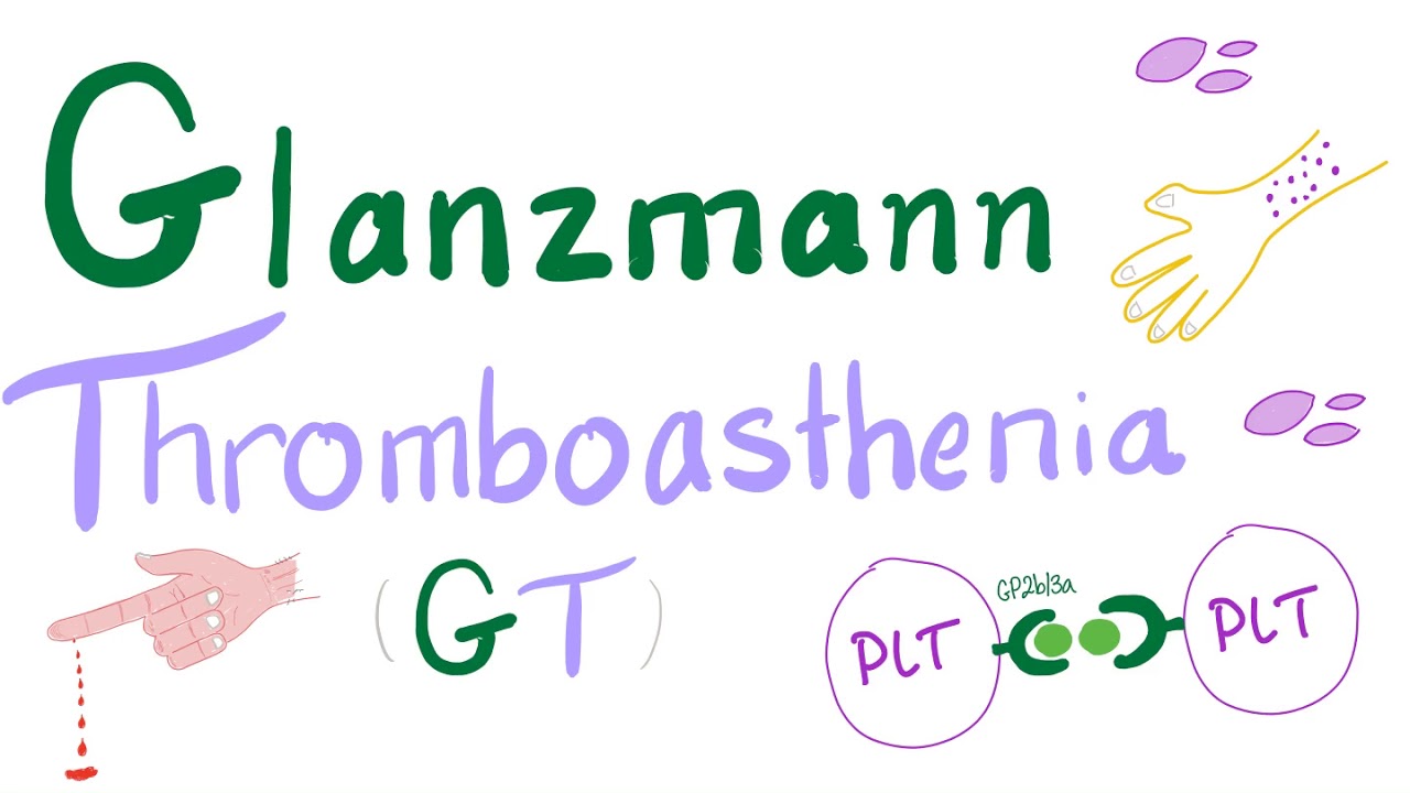 Trombastenia Glanzmanna (GT) &ndash; Zaburzenia płytek krwi &ndash; Hemostaza &ndash; Seria hematologiczna