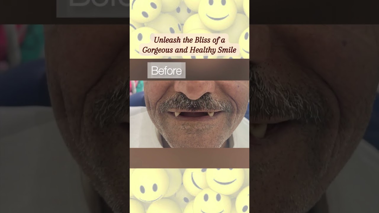 Happy World Smile day #dentistryworld #dentistry #dentalhygiene #oralhygiene #generaldentist