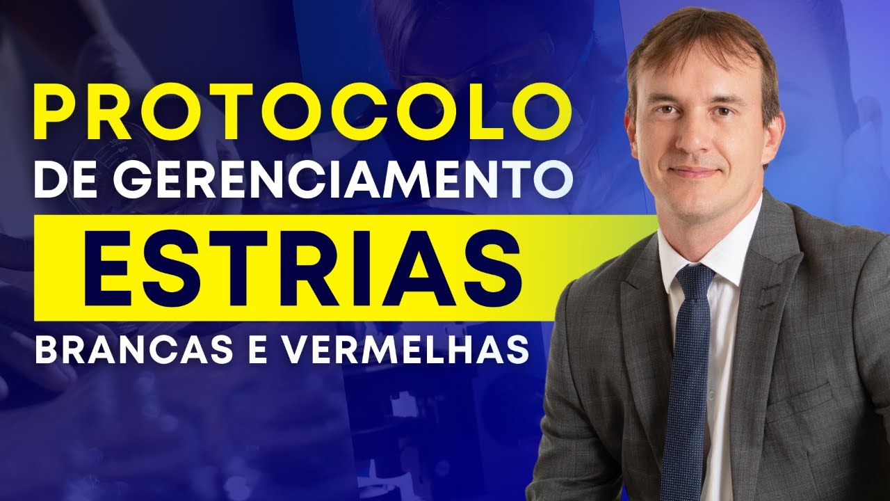 Desvende o Segredo do Gerenciamento de Estrias: Live Completa!