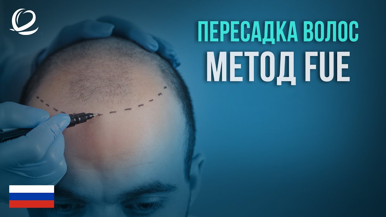 Метод трансплантации волос FUE в Clinicana Стамбул, Турция