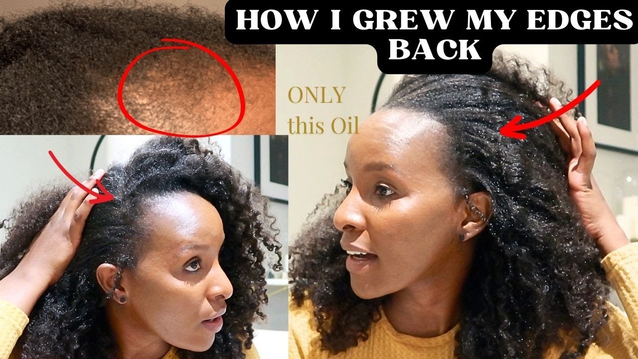 HOW TO GROW EDGES BACK WITH ONLY ONE POWERFUL OIL | How to grow bald spot