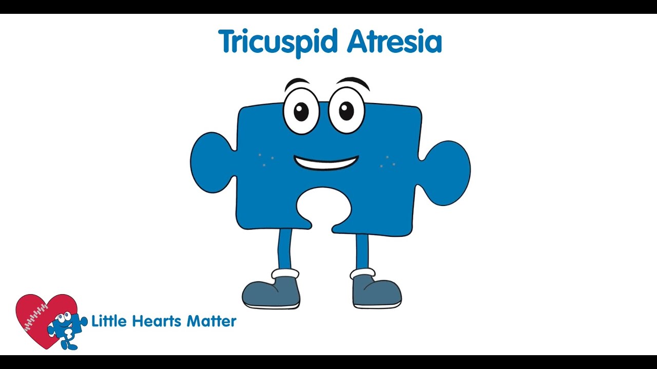 Explaining how a Tricuspid Atresia heart works